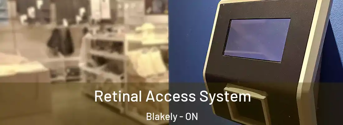  Retinal Access System Blakely - ON