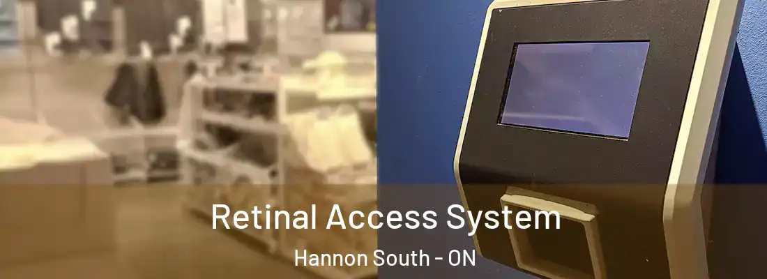  Retinal Access System Hannon South - ON