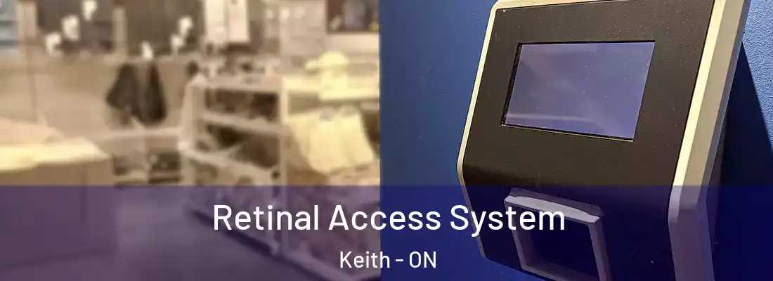  Retinal Access System Keith - ON