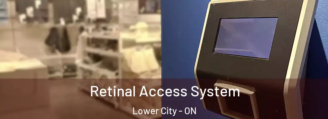  Retinal Access System Lower City - ON
