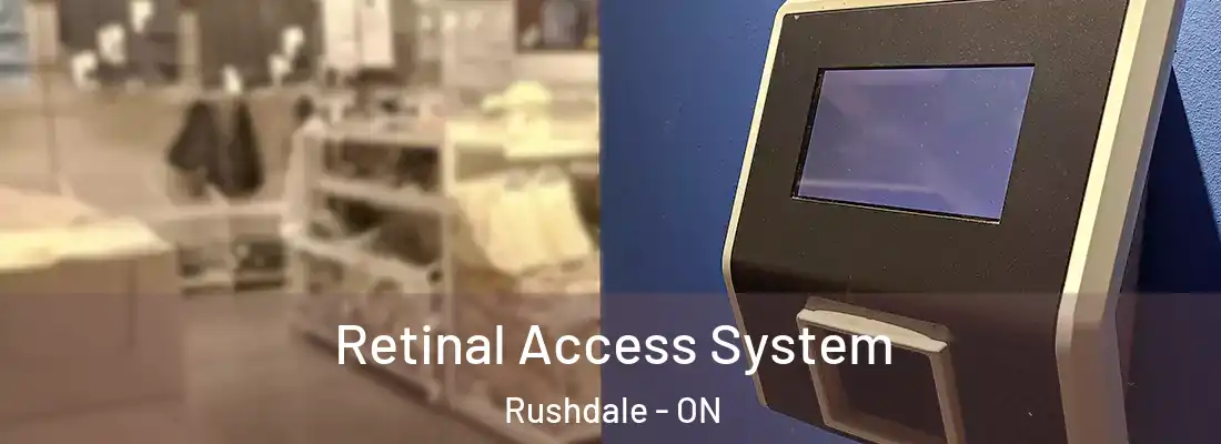  Retinal Access System Rushdale - ON